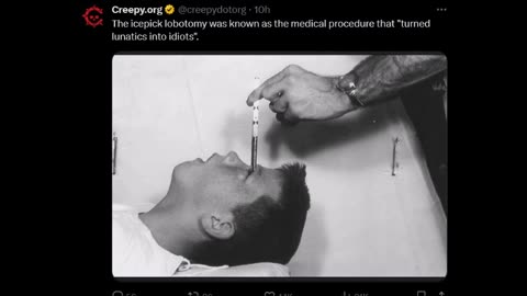 Creepy - Lobotomy