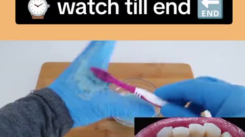 Tooth whitening in just 2 minutes