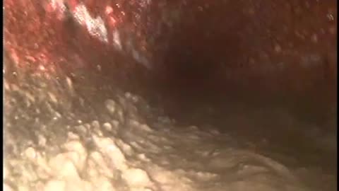 Lima 15 Brook Hollow Dr Gladstone Sewer camera