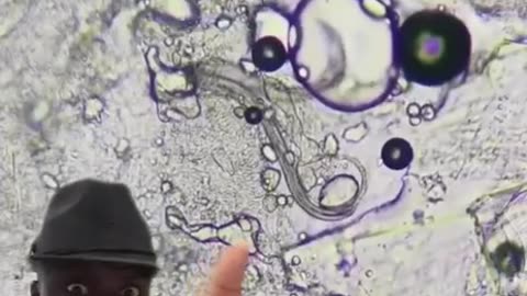 I knew there was a reason I don't like Sushi... Sushi Parasites 🤮🤮🤮