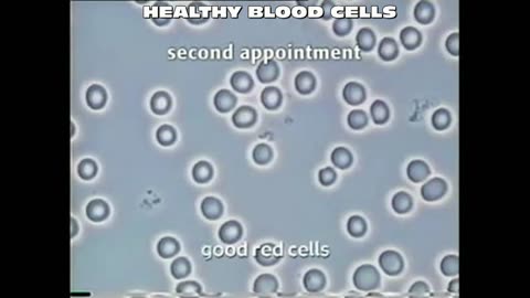 28. Blood Video Fungus Diseased Cells - Pre-Sota Silver Pulser