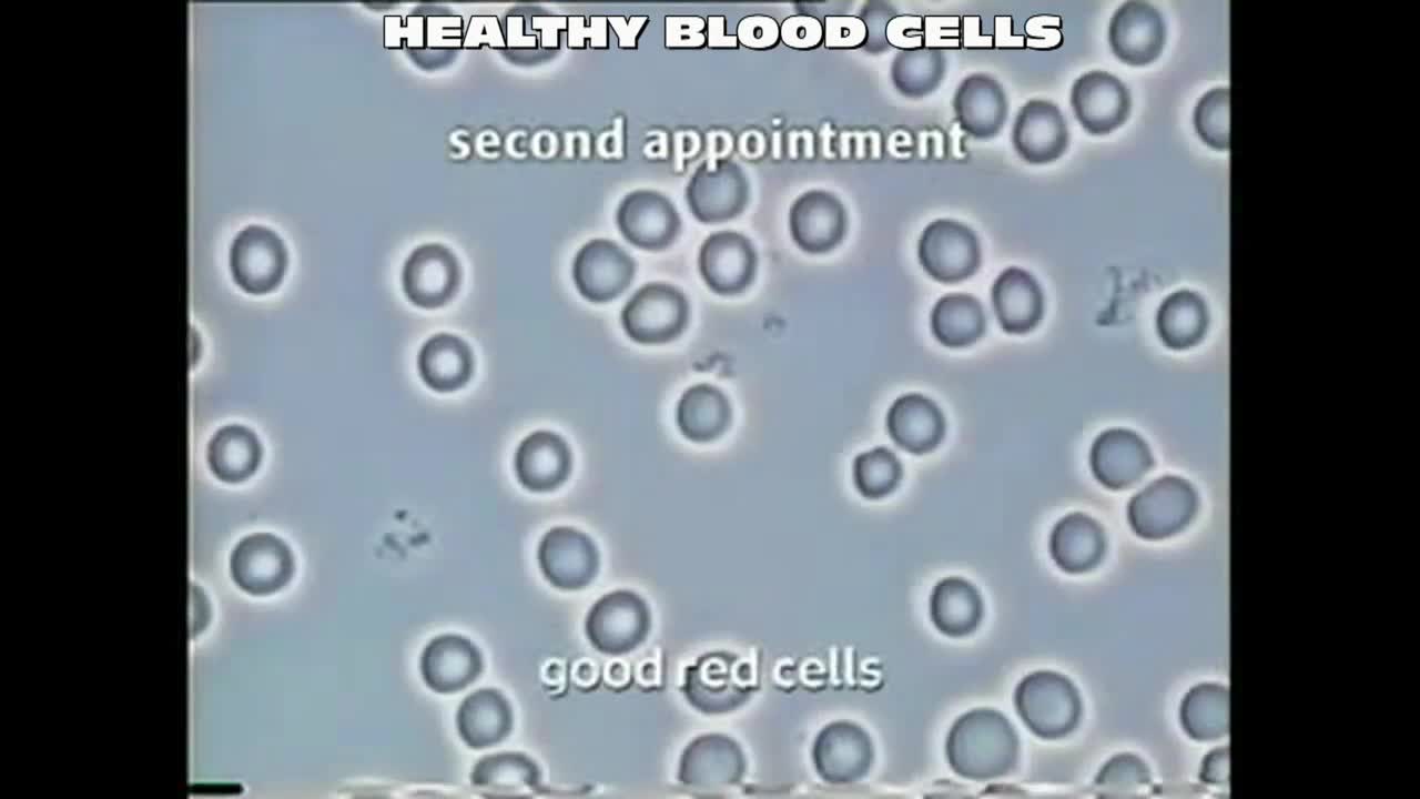 28. Blood Video Fungus Diseased Cells - Pre-Sota Silver Pulser