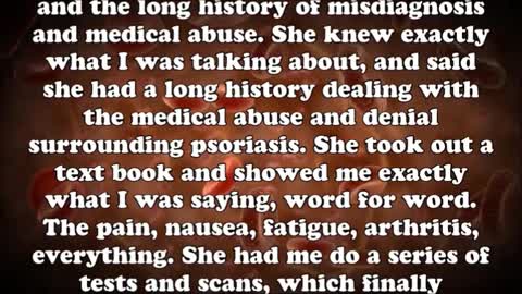 35 Struggle to survive