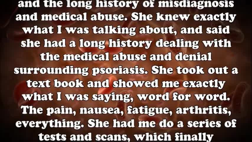 35 Struggle to survive