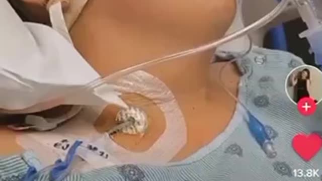 In The ICU - Multiple Cardiac Arrests From Johnson & Johnson Covid-19 Vaccine