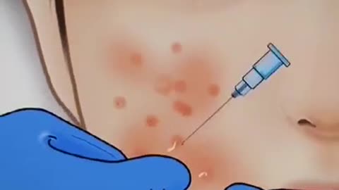 Face skin health care #shorts #health control