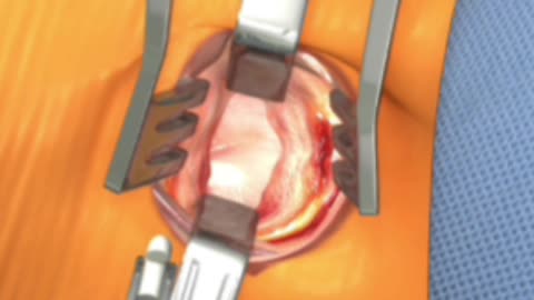 Medical surgery