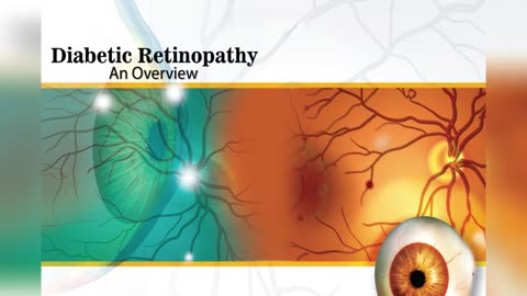 Diabetic Retinopathy