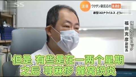 新冠實驗針劑打完針啥事也沒有的人，才是最危險的！針劑副作用引起的“延遲性後遺症”對人體傷害更大！各種皮疹、帶狀皰疹，都是免疫系統被破壞的表現！世界正在逐漸承認“疫苗災難”