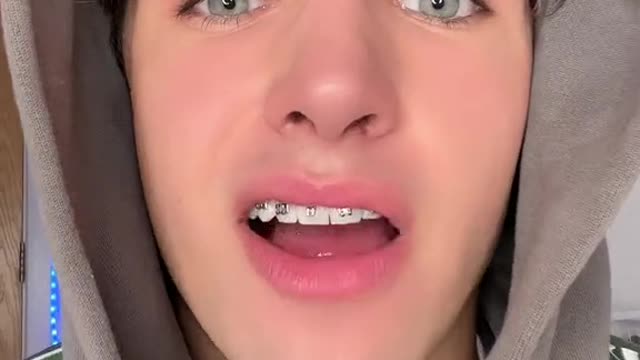 DIY BRACES PART 2