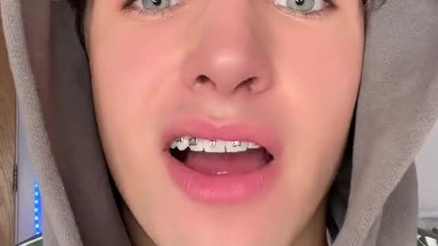 DIY BRACES PART 2