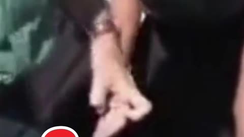 Something STRANGE about Trudeau's Hand...