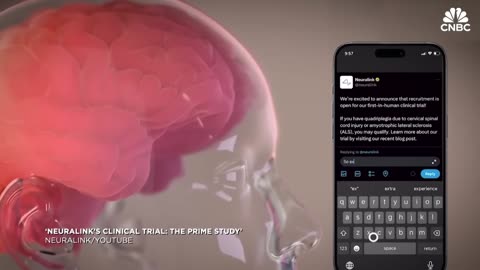 Internet of Bodies (IoB) In The Age Of Ai And The GRAVE RISKS That Follows