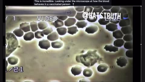 Blood Changes after Covid Shot