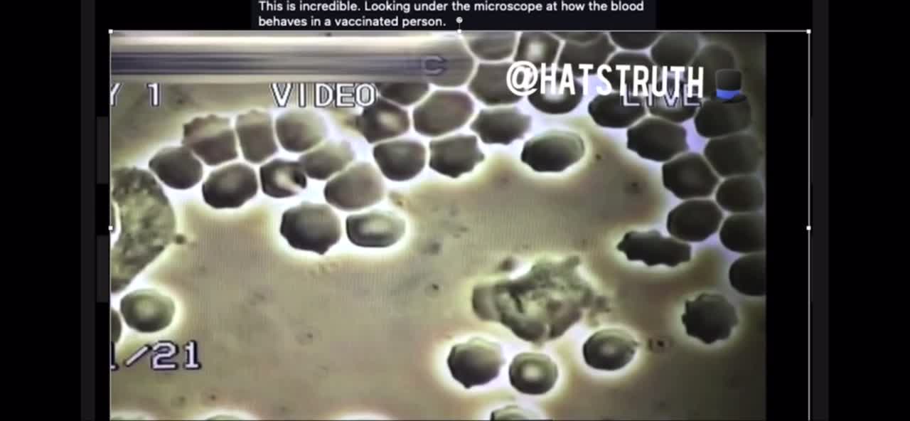 Blood Changes after Covid Shot