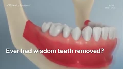 8 Medical Procedures That Are Improving Lives