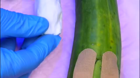 Cucumber needs surgery baby birth