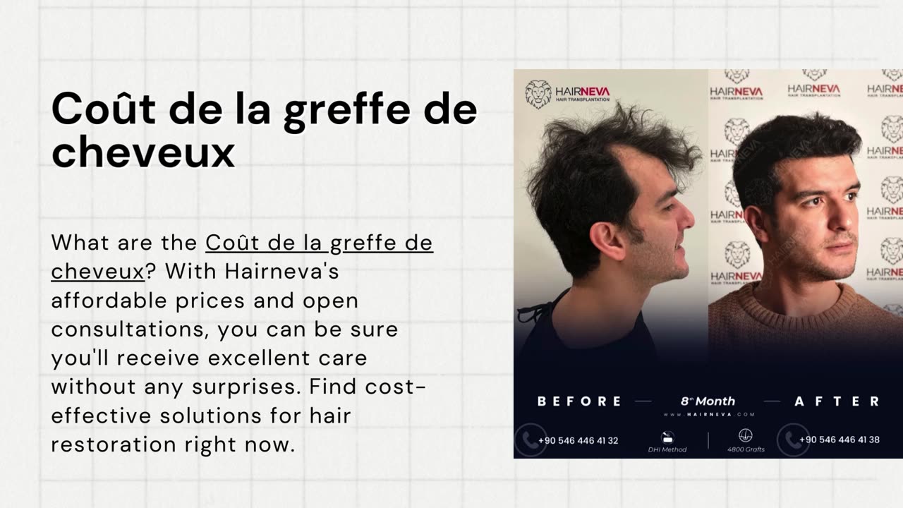 Coût de la greffe de cheveux