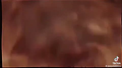 A crazy accident