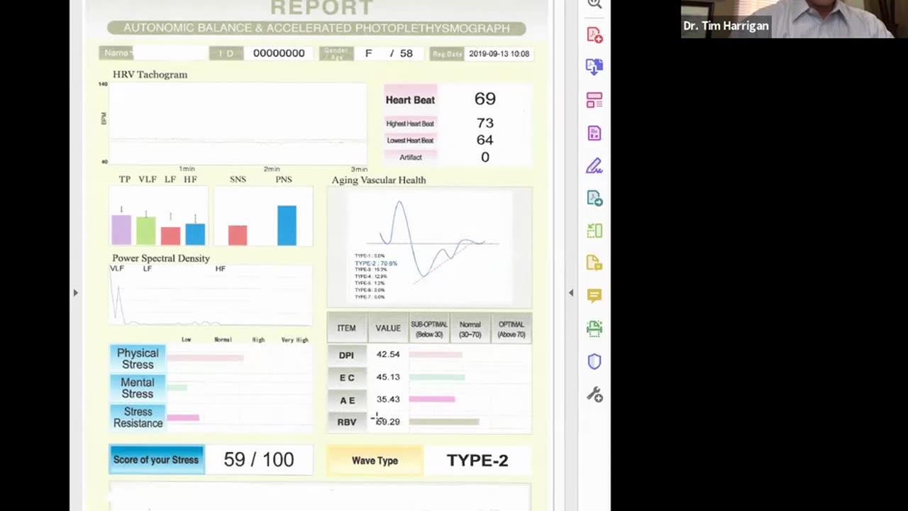 Max Pulse Testing, EKG, Cardiovascular Health and Prevention explained by Dr. Tim Harrigan