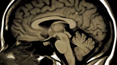 Genius brain