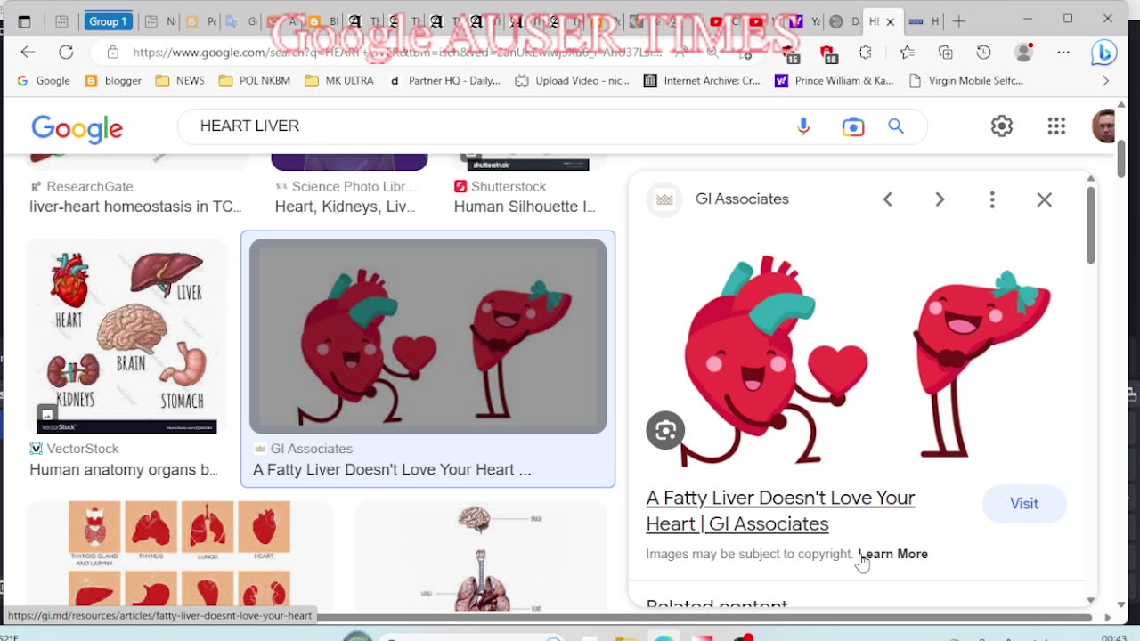 For healthy heart and liver, LOAD YOURSELF WITH COFFEE says google