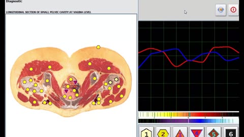 NLSystems Body scaning