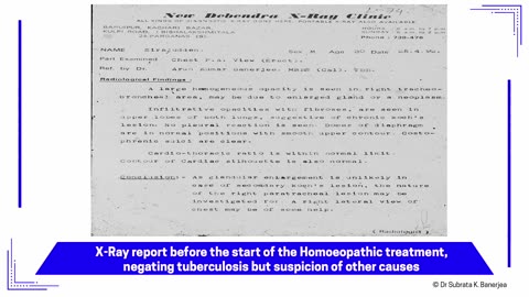 ACH - CASE PPT - NEO006-BRONCHOGENIC CARCINOMA-SL