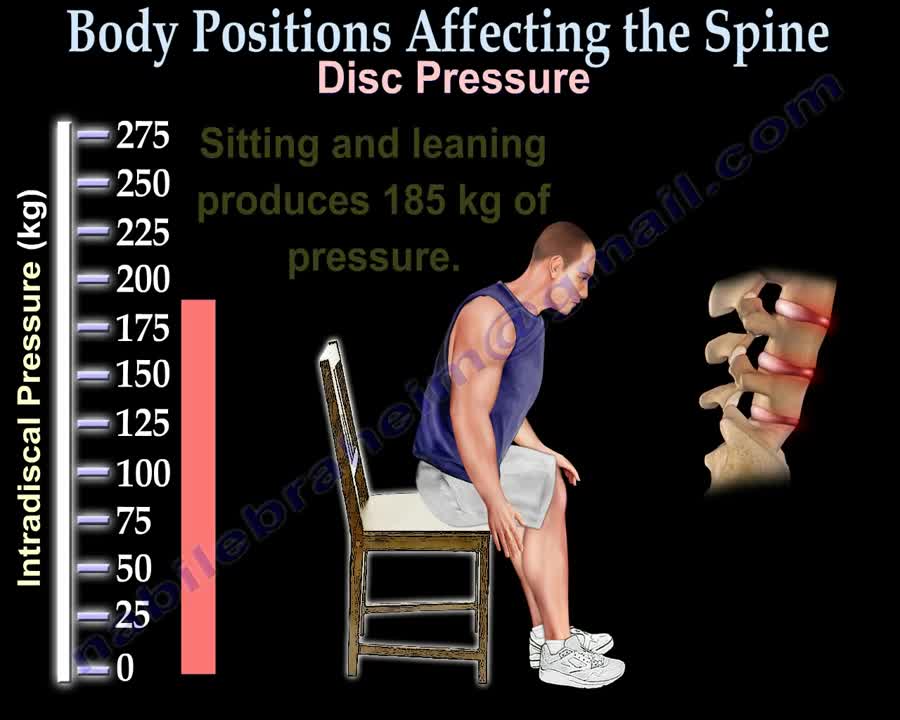 Body Positions Affecting the spine and discs - Everything You Need To Know - Nabil Ebraheim, M.D.