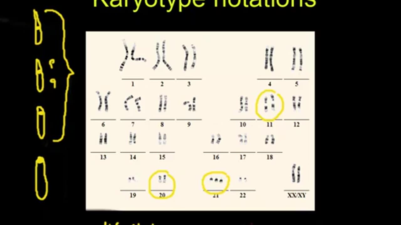 Karyotype notations