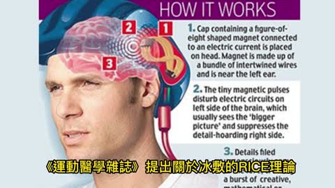 受傷熱敷？ 2點評估時機