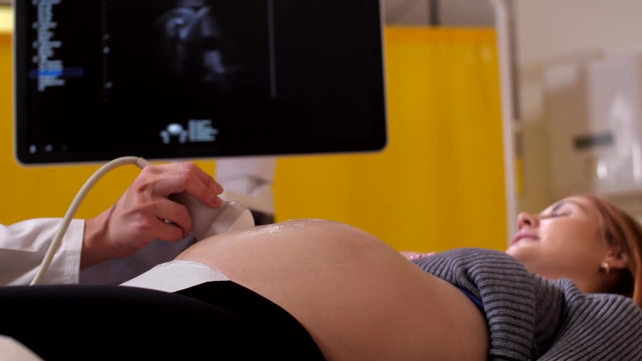 Pregnant woman at an ultrasound session