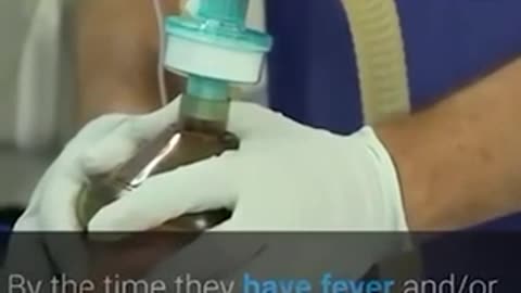 Some easy home treatments after contracting covid or omicron