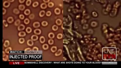 YOUR BLOOD AFTER JAB. GOOD LUCK.