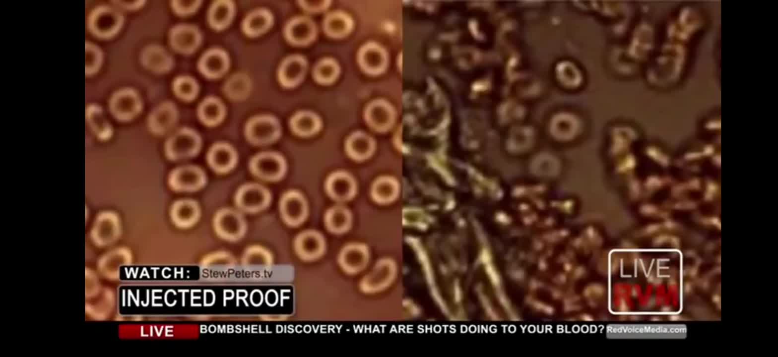 YOUR BLOOD AFTER JAB. GOOD LUCK.