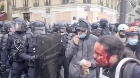 Drummer in blood is a symbol of today's protests in Paris