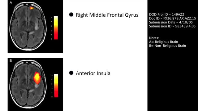 Removing the GOD gene