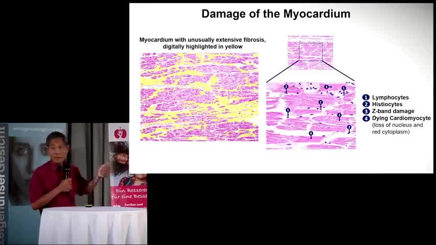 Covid Injections Personality Changes- Bhakdi,Wolf, Breggin, Attorney Dr. Reiner Fuellmich