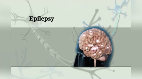 Epilepsy