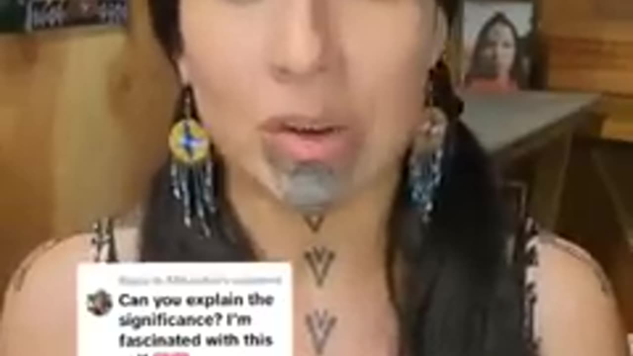 Viral