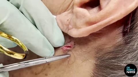 A Diamond DPOW in the Neck