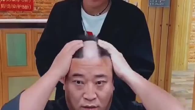 Funny Short Video Lost His Hair
