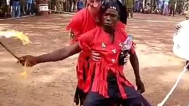 Fire stunt gone wrong
