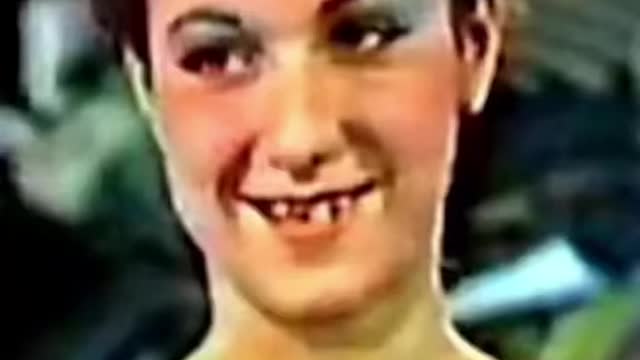 ALESSANDRA CELENTANO PRIMA E DOPO