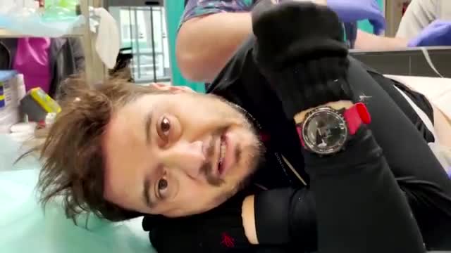 They started shooting at us' -journalist wounded in Ukraine