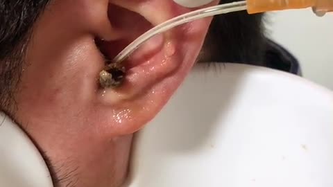 Watch ear cleaning satisfying