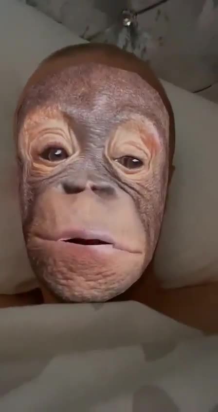 Mpox Vaccinations - Safe and Effective