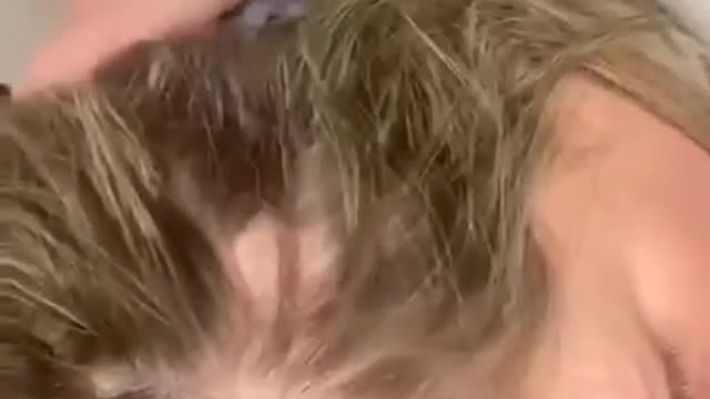 Hairloss from the covid vaxx