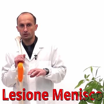 Lesione del Menisco: Devo Operarmi Sempre?