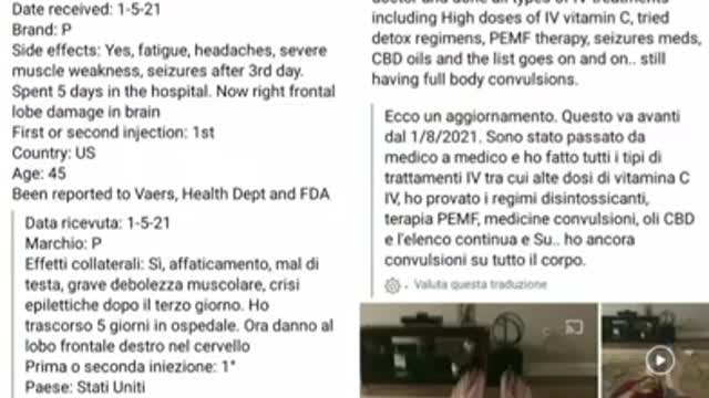 Vaccine COVID effect 11 - Effetti dei vaccini COVID " Legs epilepsy "